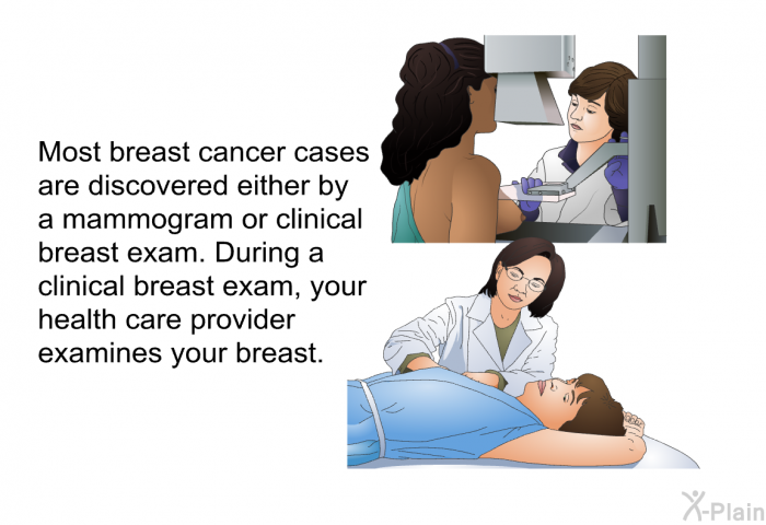 Most breast cancer cases are discovered either by a mammogram or clinical breast exam. During a clinical breast exam, your health care provider examines your breast.