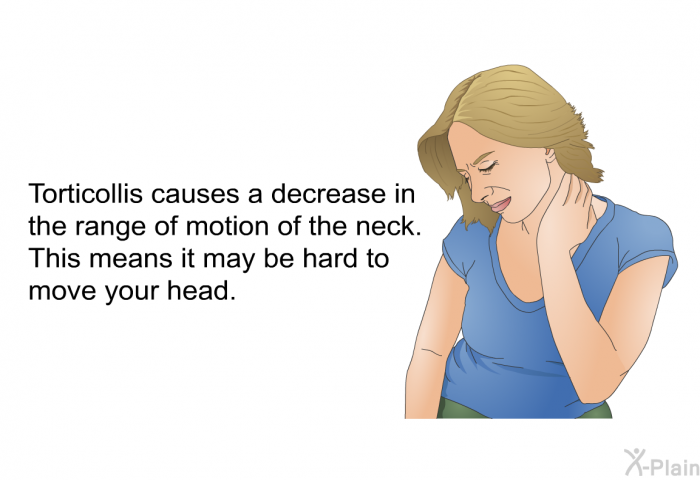 Torticollis causes a decrease in the range of motion of the neck. This means it may be hard to move your head.