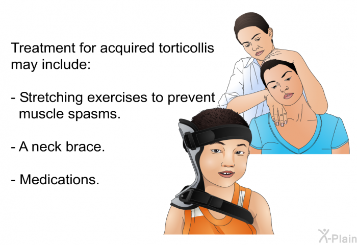 Treatment for acquired torticollis may include:  Stretching exercises to prevent muscle spasms. A neck brace. Medications.