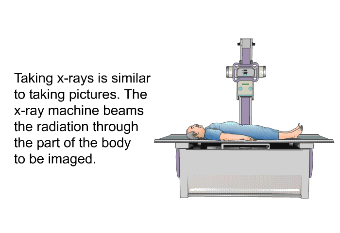 Taking x-rays is similar to taking pictures. The x-ray machine beams the radiation through the part of the body to be imaged.