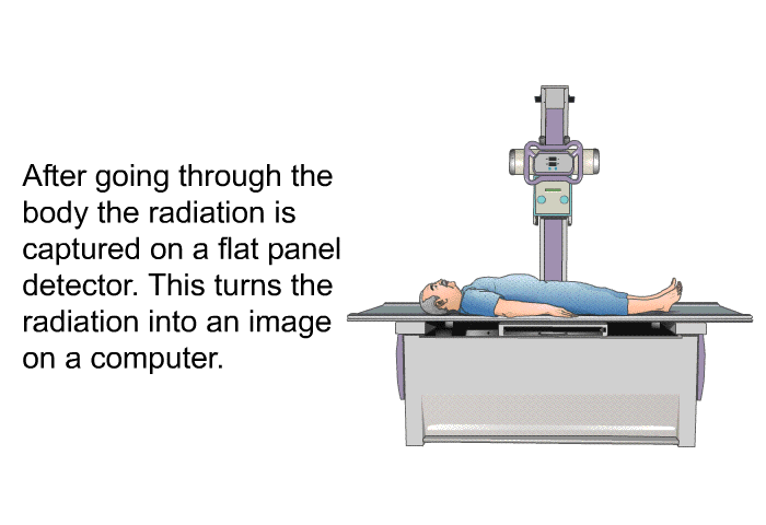 After going through the body the radiation is captured on a flat panel detector. This turns the radiation into an image on a computer.