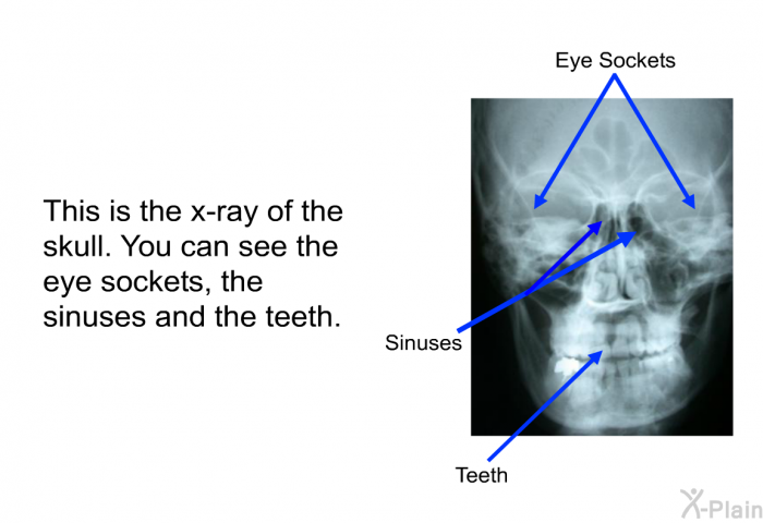 This is the x-ray of the skull. You can see the eye sockets, the sinuses and the teeth.