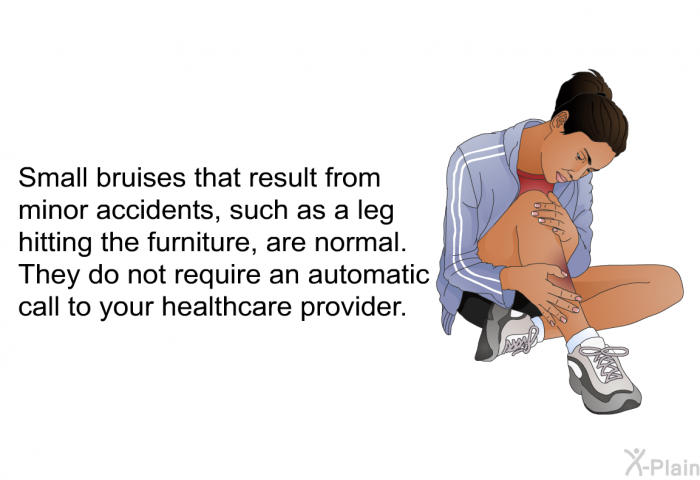 Small bruises that result from minor accidents, such as a leg hitting the furniture, are normal. They do not require an automatic call to your health care provider.