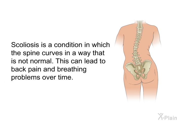 Scoliosis is a condition in which the spine curves in a way that is not normal. This can lead to back pain and breathing problems over time.