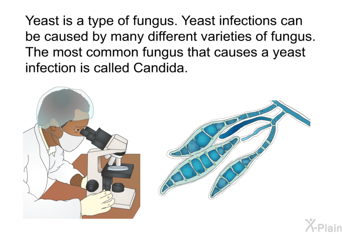 Yeast is a type of fungus. Yeast infections can be caused by many different varieties of fungus. The most common fungus that causes a yeast infection is called Candida.