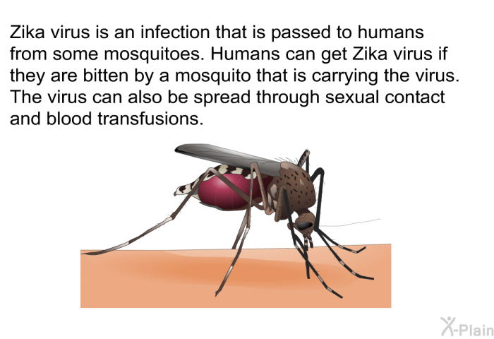 Zika virus is an infection that is passed to humans from some mosquitoes. Humans can get Zika virus if they are bitten by a mosquito that is carrying the virus. The virus can also be spread through sexual contact and blood transfusions.