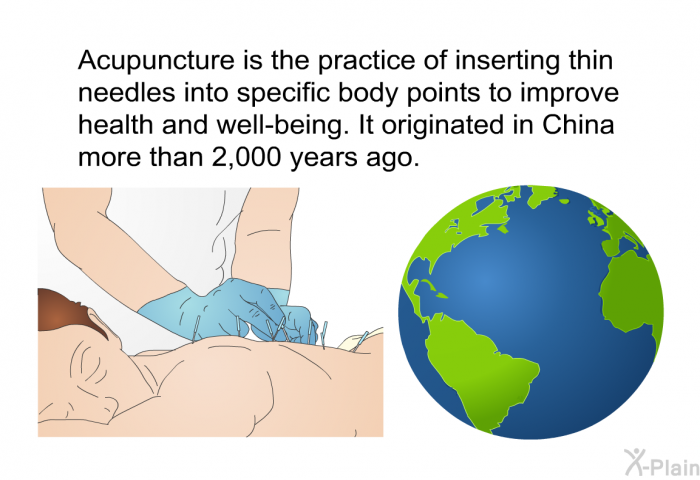 Acupuncture is the practice of inserting thin needles into specific body points to improve health and well-being. It originated in China more than 2,000 years ago.