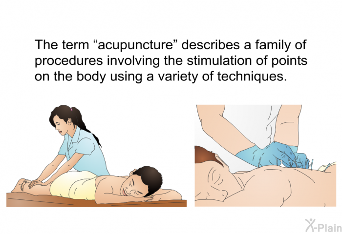 The term “acupuncture” describes a family of procedures involving the stimulation of points on the body using a variety of techniques.