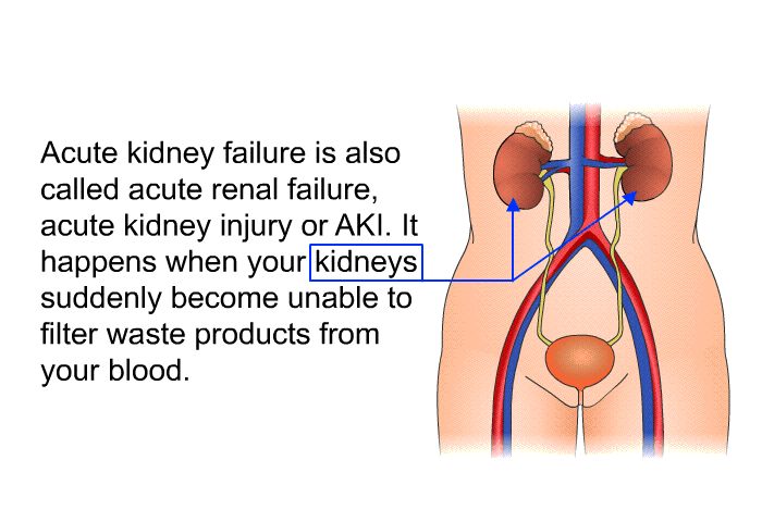 Acute kidney failure is also called acute renal failure, acute kidney injury or AKI. It happens when your kidneys suddenly become unable to filter waste products from your blood.