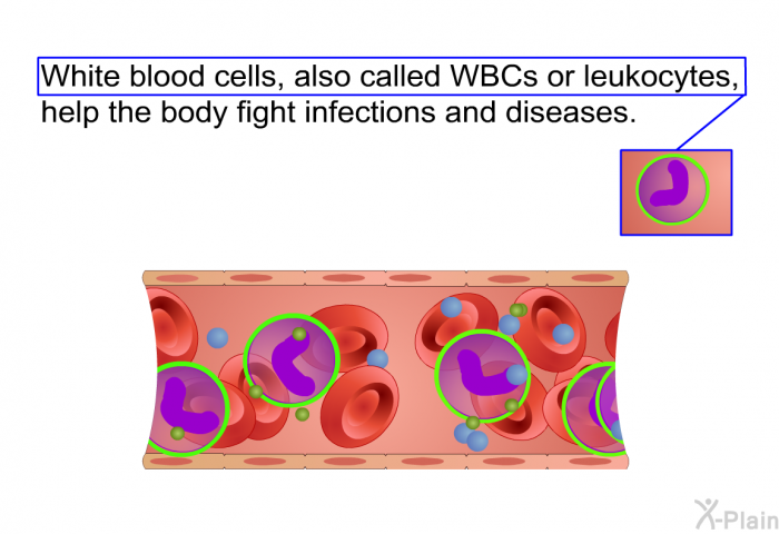 White blood cells, also called WBCs or leukocytes, help the body fight infections and diseases.