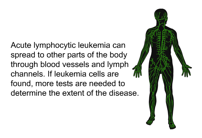 Acute lymphocytic leukemia can spread to other parts of the body through blood vessels and lymph channels. If leukemia cells are found, more tests are needed to determine the extent of the disease.