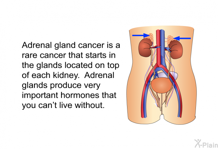 Adrenal gland cancer is a rare cancer that starts in the glands located on top of each kidney. Adrenal glands produce very important hormones that you can't live without.