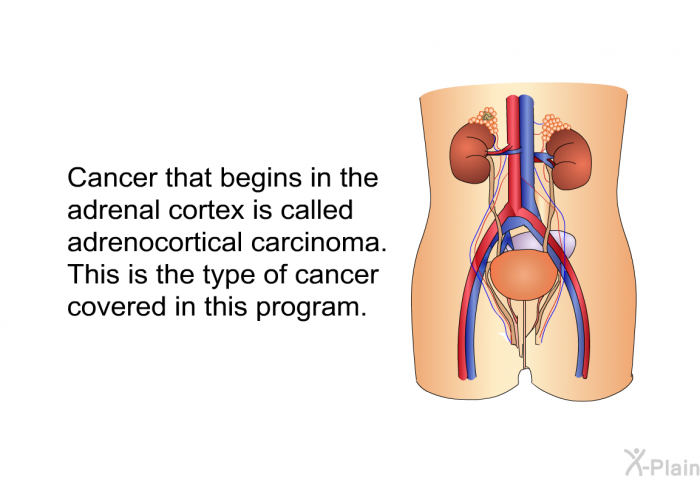 Cancer that begins in the adrenal cortex is called adrenocortical carcinoma. This is the type of cancer covered in this program.