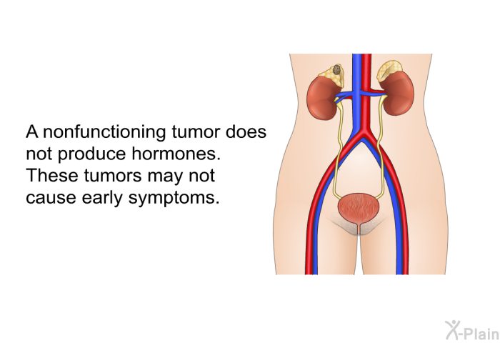 A nonfunctioning tumor does not produce hormones. These tumors may not cause early symptoms.