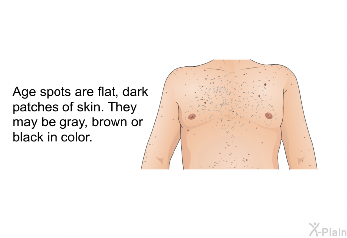 Age spots are flat, dark patches of skin. They may be gray, brown or black in color.