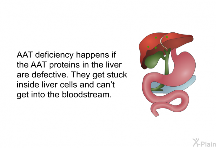 AAT deficiency happens if the AAT proteins in the liver are defective. They get stuck inside liver cells and can't get into the bloodstream.