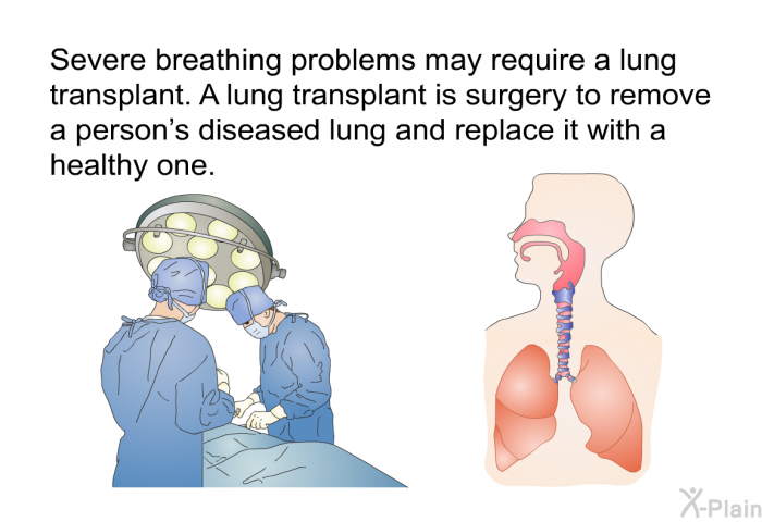 Severe breathing problems may require a lung transplant. A lung transplant is surgery to remove a person's diseased lung and replace it with a healthy one.
