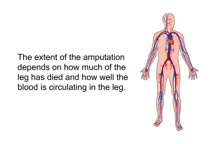 The extent of the amputation depends on how much of the leg has died and how well the blood is circulating in the leg.