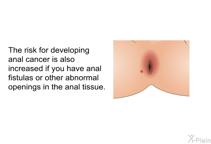 The risk for developing anal cancer is also increased if you have anal fistulas or other abnormal openings in the anal tissue.