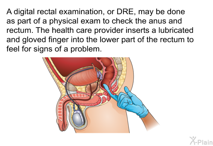 A digital rectal examination, or DRE, may be done as part of a physical exam to check the anus and rectum. The health care provider inserts a lubricated and gloved finger into the lower part of the rectum to feel for signs of a problem.