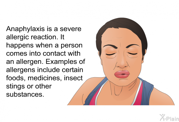 Anaphylaxis is a severe allergic reaction. It happens when a person comes into contact with an allergen. Examples of allergens include certain foods, medicines, insect stings or other substances.