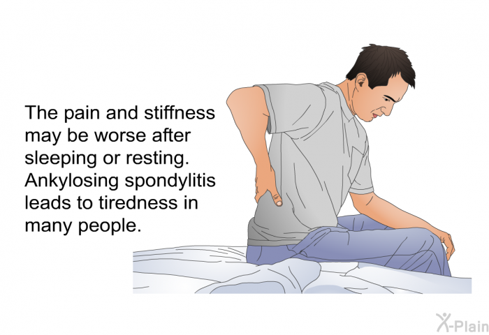 The pain and stiffness may be worse after sleeping or resting. Ankylosing spondylitis leads to tiredness in many people.