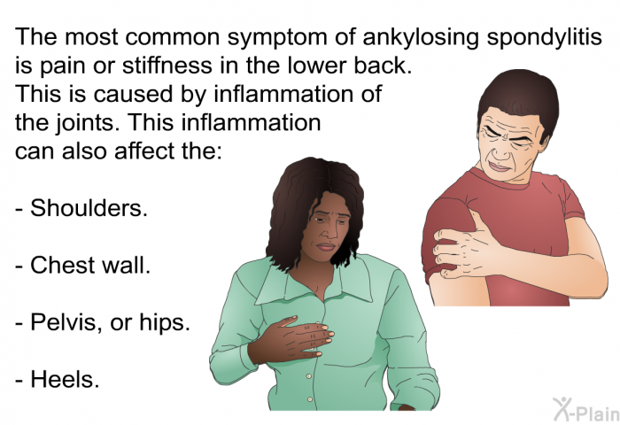 The most common symptom of ankylosing spondylitis is pain or stiffness in the lower back. This is caused by inflammation of the joints. This inflammation can also affect the:  Shoulders. Chest wall. Pelvis, or hips. Heels.