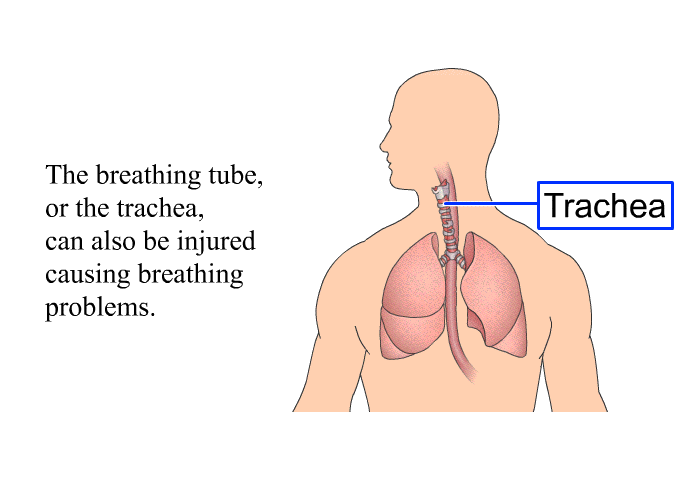The breathing tube, or the trachea, can also be injured, causing breathing problems.