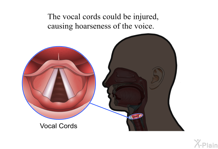 The vocal cords could be in­jured, causing hoarseness of the voice.