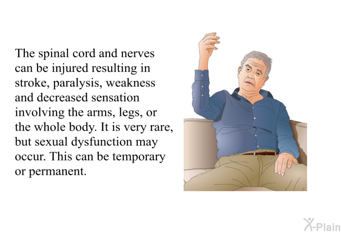 The spinal cord and nerves can be injured, resulting in stroke, paralysis, weakness, and de­creased sensation involving the arms, legs, or the whole body. It is very rare, but sexual dys­function may occur. This can be temporary or per­manent.