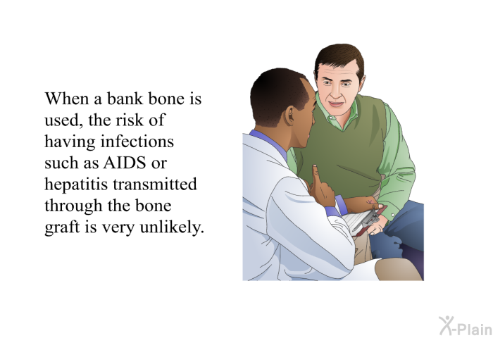 When a bank bone is used, the risk of having infections such as AIDS or hepatitis transmitted through the bone graft is very unlikely.