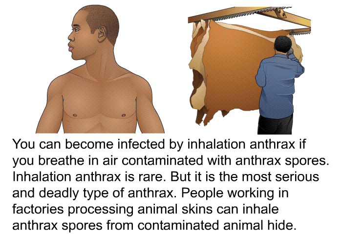 You can become infected by inhalation anthrax if you breathe in air contaminated with anthrax spores. Inhalation anthrax is rare. But it is the most serious and deadly type of anthrax. People working in factories processing animal skins can inhale anthrax spores from contaminated animal hide.