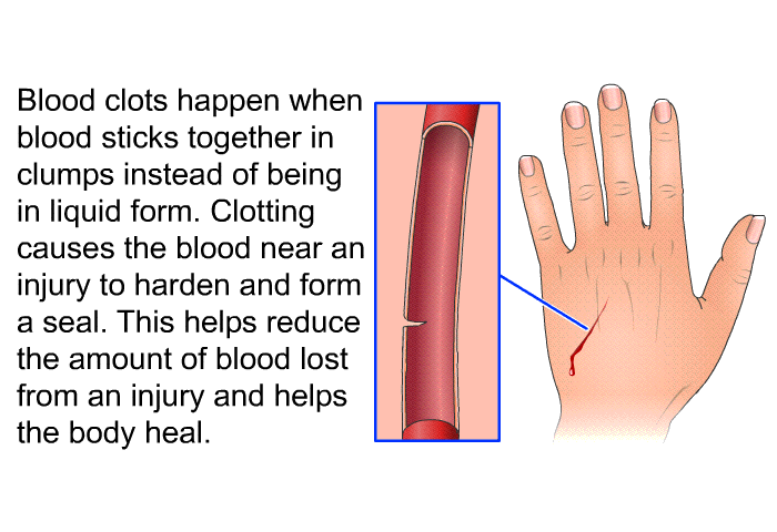 Blood clots happen when blood sticks together in clumps instead of being in liquid form. Clotting causes the blood near an injury to harden and form a seal. This helps reduce the amount of blood lost from an injury and helps the body heal.