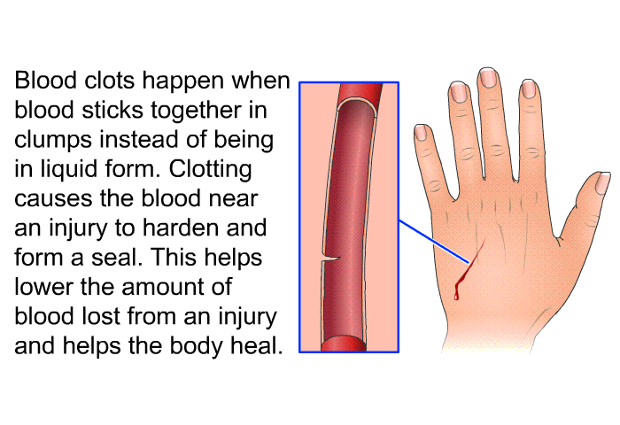 Blood clots happen when blood sticks together in clumps instead of being in liquid form. Clotting causes the blood near an injury to harden and form a seal. This helps lower the amount of blood lost from an injury and helps the body heal.