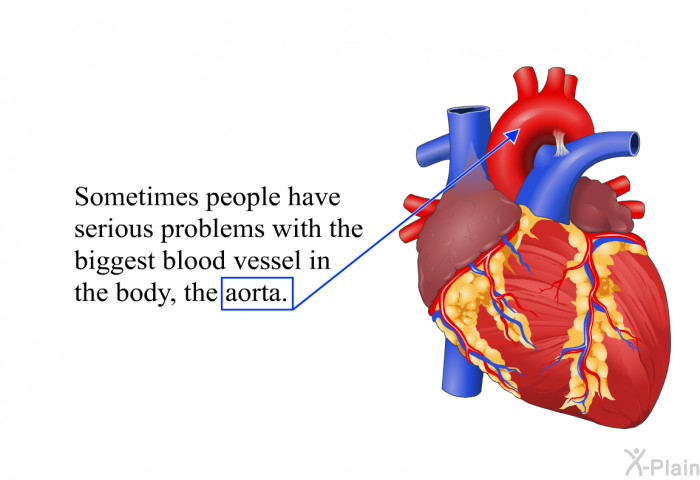 Sometimes people have serious problems with the biggest blood vessel in the body, the aorta.