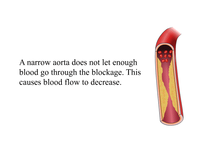 A narrow aorta does not let enough blood to go through the blockage. This causes blood flow to decrease.