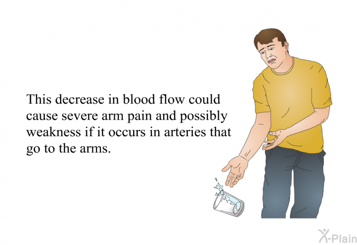 This decrease in blood flow could cause severe arm pain and possibly weakness if it occurs in arteries that go to the arms.