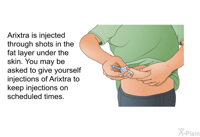 Arixtra is injected through shots in the fat layer under the skin. You may be asked to give yourself injections of Arixtra to keep injections on scheduled times.