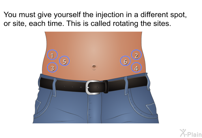 You must give yourself the injection in a different spot, or site, each time. This is called <I>rotating the sites</I>.