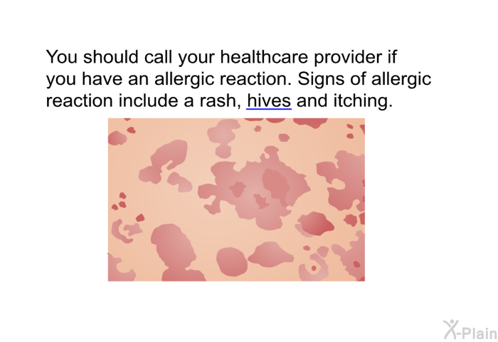 You should call your healthcare provider if you have an allergic reaction. Signs of allergic reaction include a rash, hives and itching.