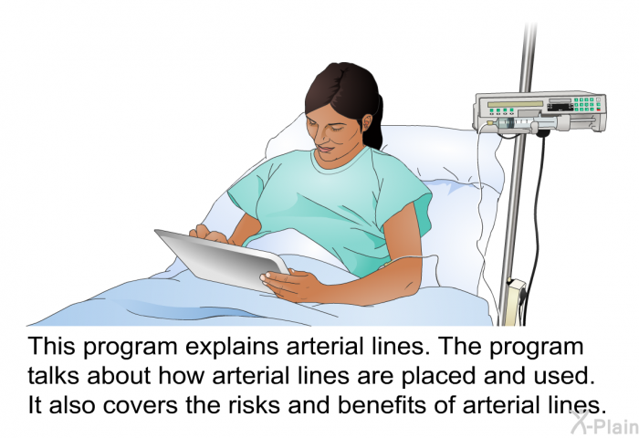 This health information explains arterial lines. The health information talks about how arterial lines are placed and used. It also covers the risks and benefits of arterial lines.