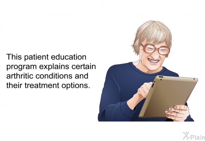 This health information explains certain arthritic conditions and their treatment options.