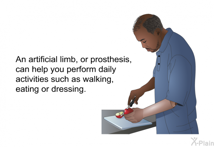 An artificial limb, or prosthesis, can help you perform daily activities such as walking, eating or dressing.