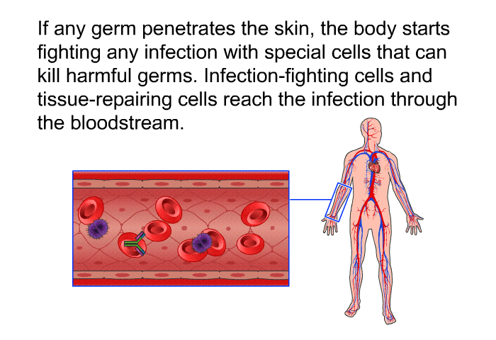 If any germ penetrates the skin, the body starts fighting any infection with special cells that can kill harmful germs. Infection-fighting cells and tissue-repairing cells reach the infection through the bloodstream.
