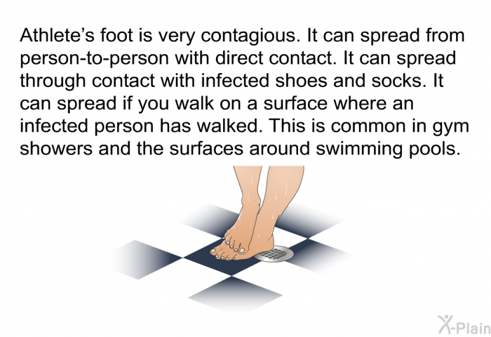 Athlete's foot is very contagious. It can spread from person-to-person with direct contact. It can spread through contact with infected shoes and socks. It can spread if you walk on a surface where an infected person has walked. This is common in gym showers and the surfaces around swimming pools.