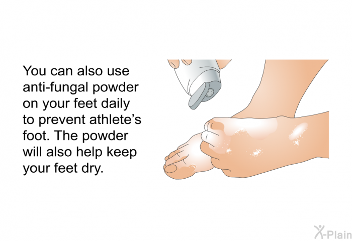 You can also use anti-fungal powder on your feet daily to prevent athlete's foot. The powder will also help keep your feet dry.
