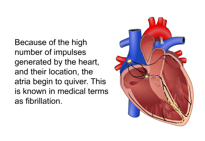 Because of the high number of impulses generated by the heart, and their location, the atria begin to quiver. This is known in medical terms as fibrillation.
