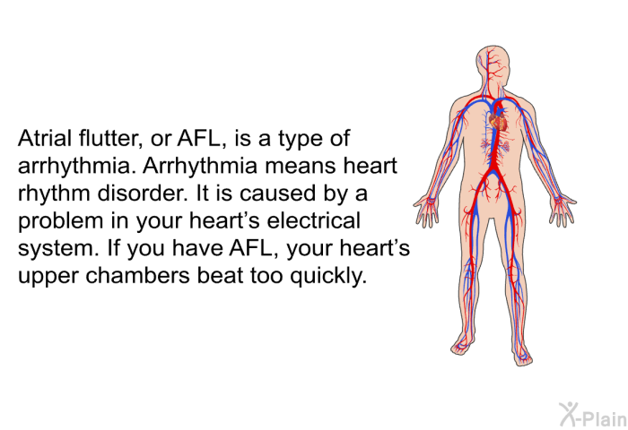 Atrial flutter, or AFL, is a type of arrhythmia. Arrhythmia means heart rhythm disorder. It is caused by a problem in your heart's electrical system. If you have AFL, your heart's upper chambers beat too quickly.