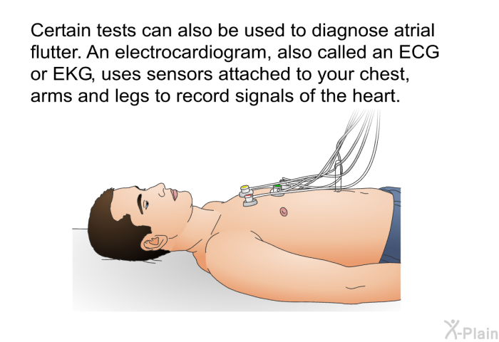 Certain tests can also be used to diagnose atrial flutter. An electrocardiogram, also called an ECG or EKG, uses sensors attached to your chest, arms and legs to record signals of the heart.
