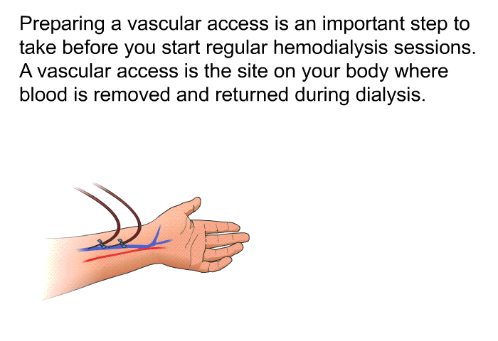 Preparing a vascular access is an important step to take before you start regular hemodialysis sessions. A vascular access is the site on your body where blood is removed and returned during dialysis.